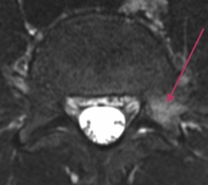 Lannerangan magneettikuva 1